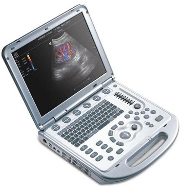 Chiropractic Alexandria VA Muscuoloskeletal Ultrasound Monitor